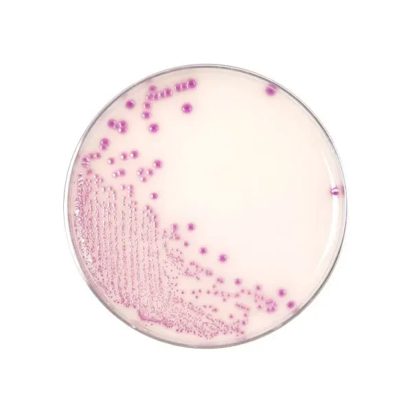 اشرشیا-کلی-o157